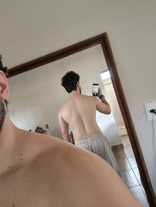 Antes - Guilherme